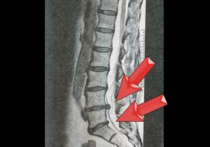 complications chorus protest COLOANA MEDICALA Clinica de ortopedie si vertebrologie - Bucuresti...